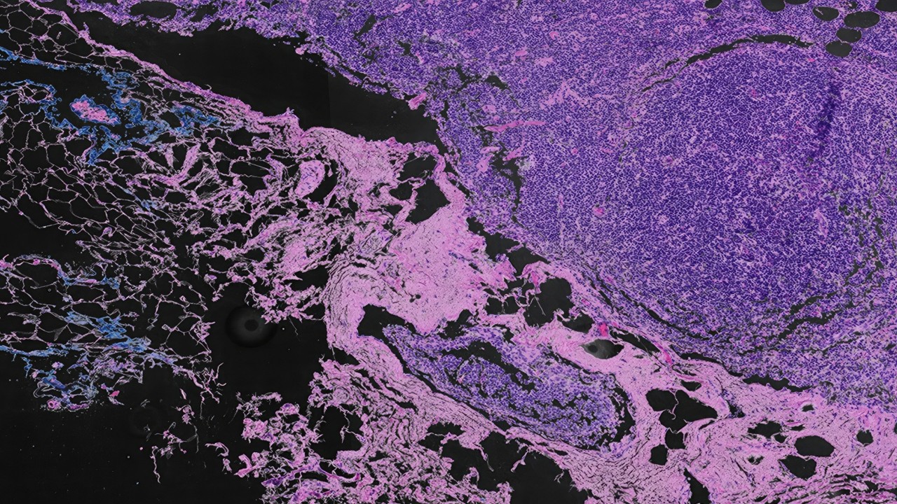 Digital Pathology Workflows Using cuCIM and NVIDIA GPUDirect Storage